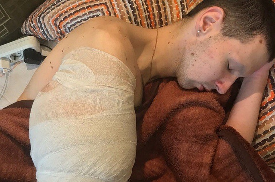 Кирилл страдает от боли и температуры