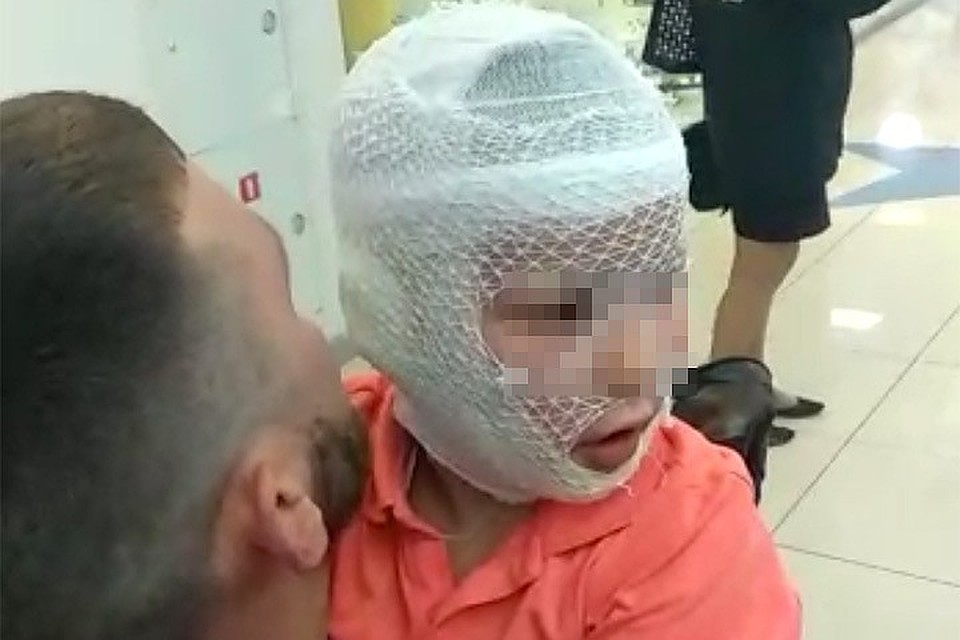 Гоша сразу после происшествия.
