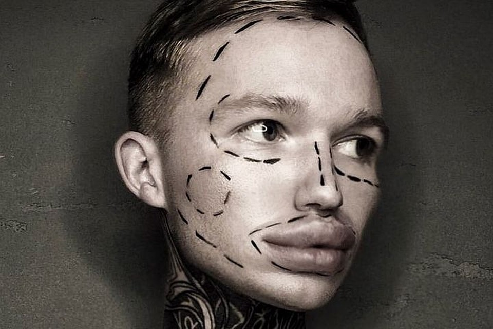 Федор признался: надул губы ради «прикола». Фото: https://www.instagram.com/livovichfedor/