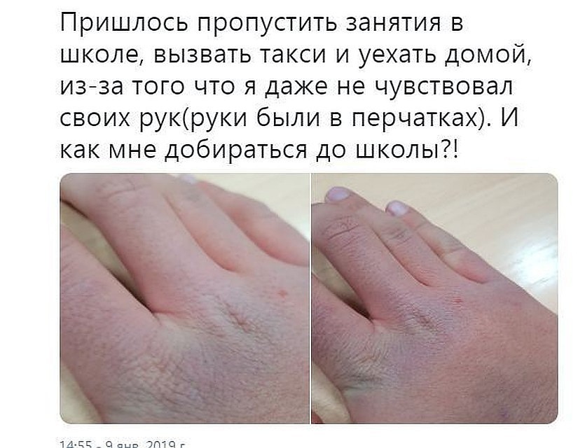 Чиновники выразили сожаление по поводу того, что школьник обморозил руки и пропустил занятия
