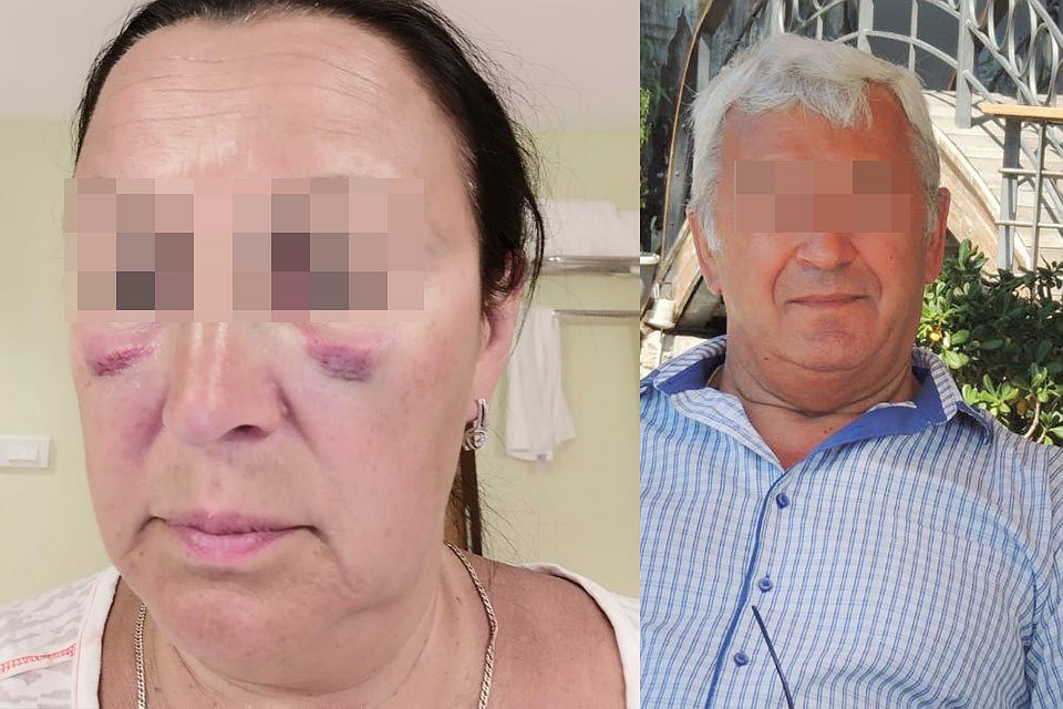 Поводом к рукоприкладству стала ссора между супругами.