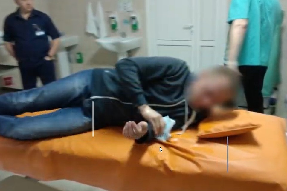У гомельчанина из желудка достали пакет с психотропом. Фото: скриншот видео УВД