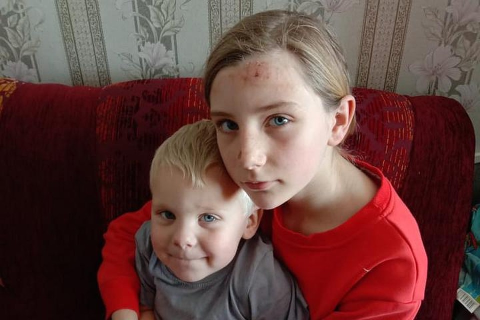 Лера получила ожоги, малыш, к счастью, не пострадал