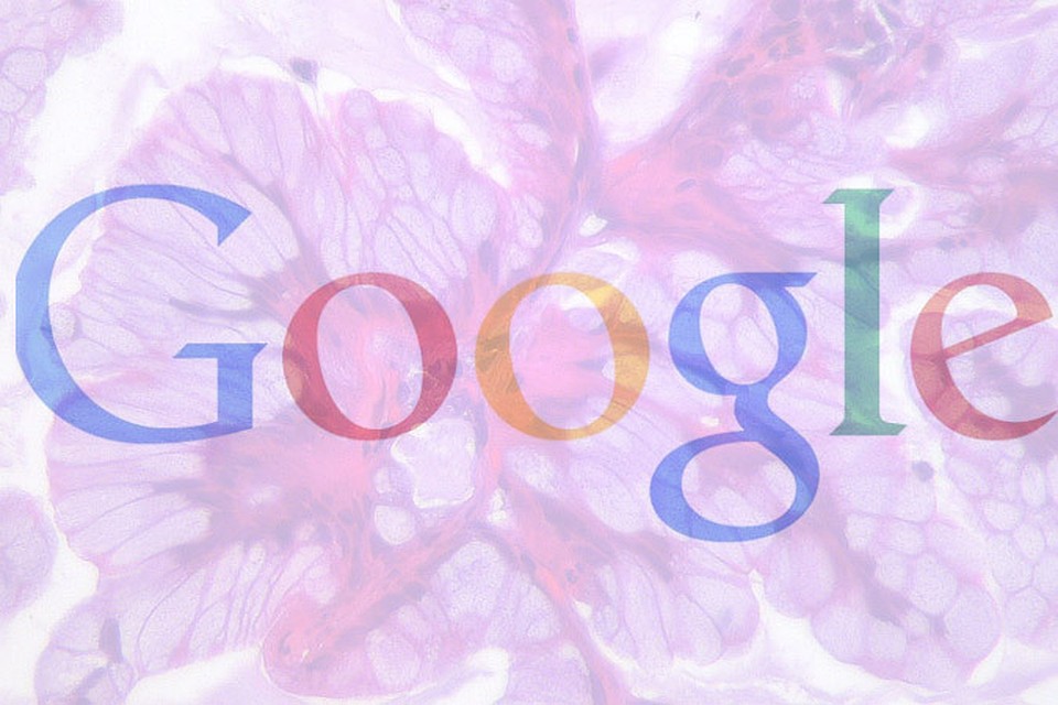 Google разрабатывает устройства, которые будут определять рак и другие болезни