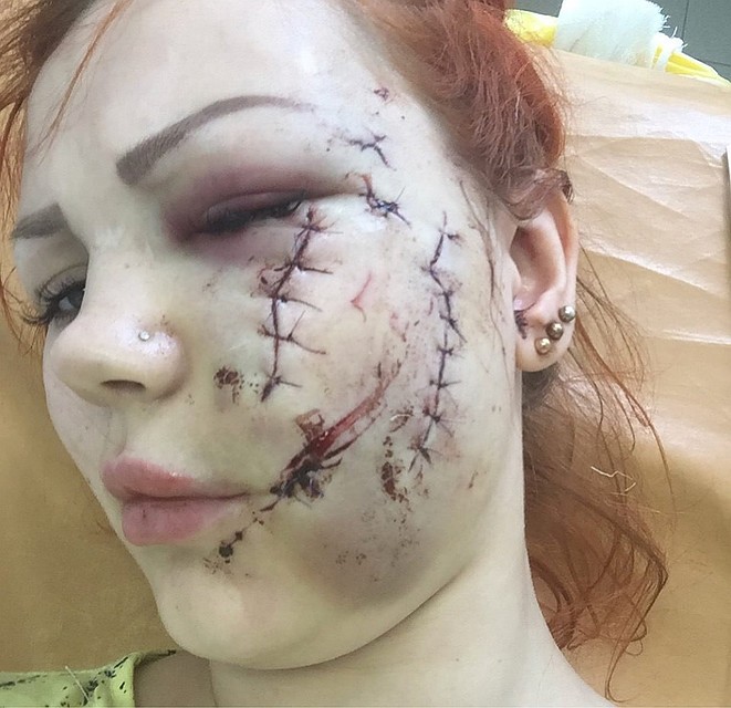 Ирина нуждается в пластической операции.