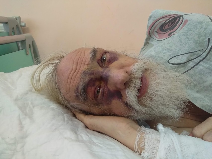 После падения глыбы Сергей попал в реанимацию. Фото: соцсети.