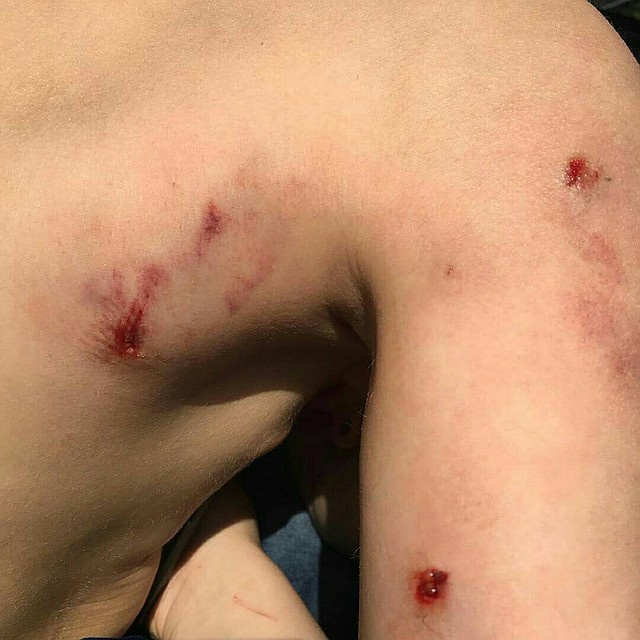 Мальчик поправляется, его жизни ничто не угрожает. \ФОТО: Инстаграм матери пострадавшего