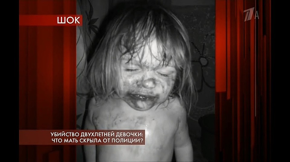 Малышку избивали и уже не первый раз