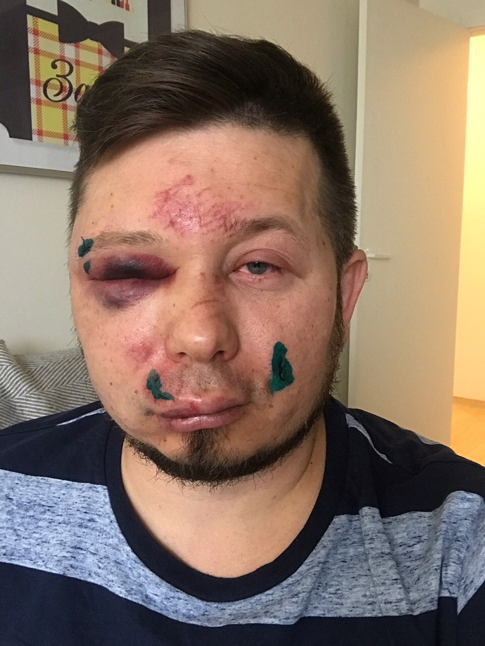 Общественник уже написал заявление в полицию, просит правоохранителей долго не раскачиваться. Фото: личный архив.