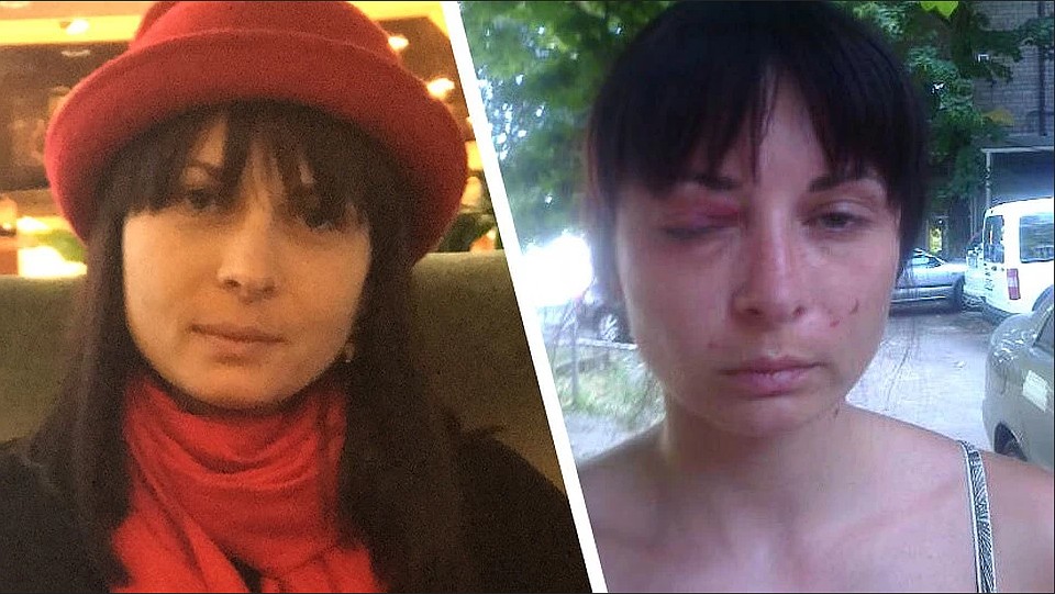 3- Дарья Мастикашева до и после пыток в СБУ. Фото: Фейсбук адвоката Валентина Рыбина