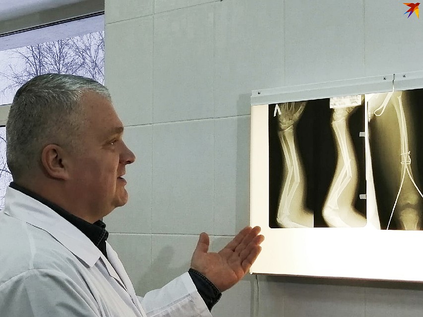 Некоторые переломы требуют не только наложения гипса, но и оперативного вмешательства Фото: Екатерина АРДАШЕВА