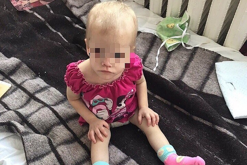 Когда малышку забрали от матери, она стала быстро идти на поправку. Фото: предоставлено волонтерами