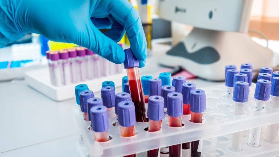 MCV в анализе крови у женщин и мужчин