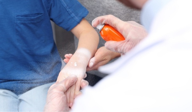 Что делать при ожоге