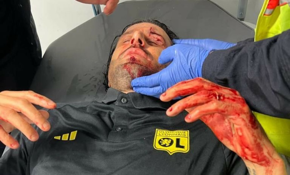 Гроссо в крови, соцсети Лиона